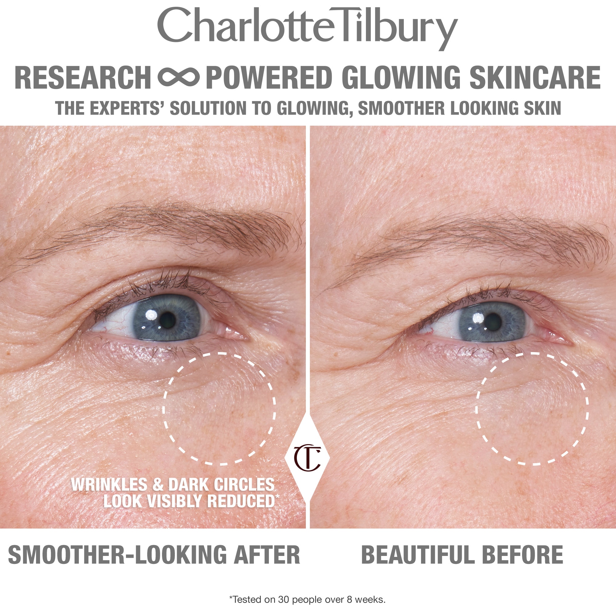 CRYO-RECOVERY EYE SERUM (SUERO PARA CONTORNO DE OJOS)